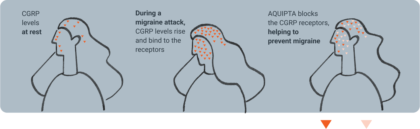Infographic of CGRP levels at rest, during a migraine attack, and how Aquipta binds to CGRP, helping to prevent migraine