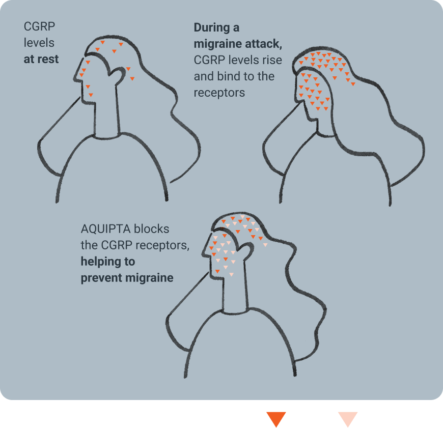 Infographic of CGRP levels at rest, during a migraine attack, and how Aquipta binds to CGRP, helping to prevent migraine